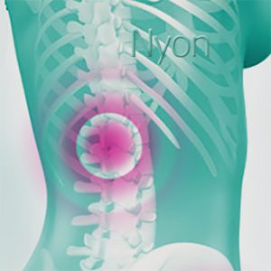 Articulations douloureuses