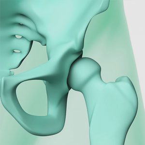 La Mésothérapie contre les douleurs